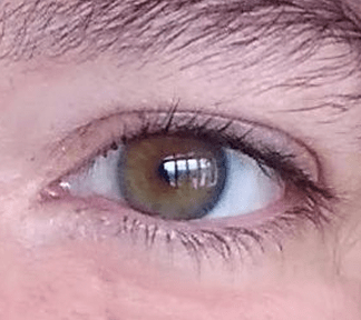 Ojo Julieta