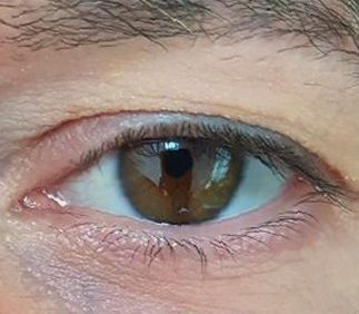 Ojo Carlos